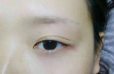 林东升老师女人半截眉毛面相分析