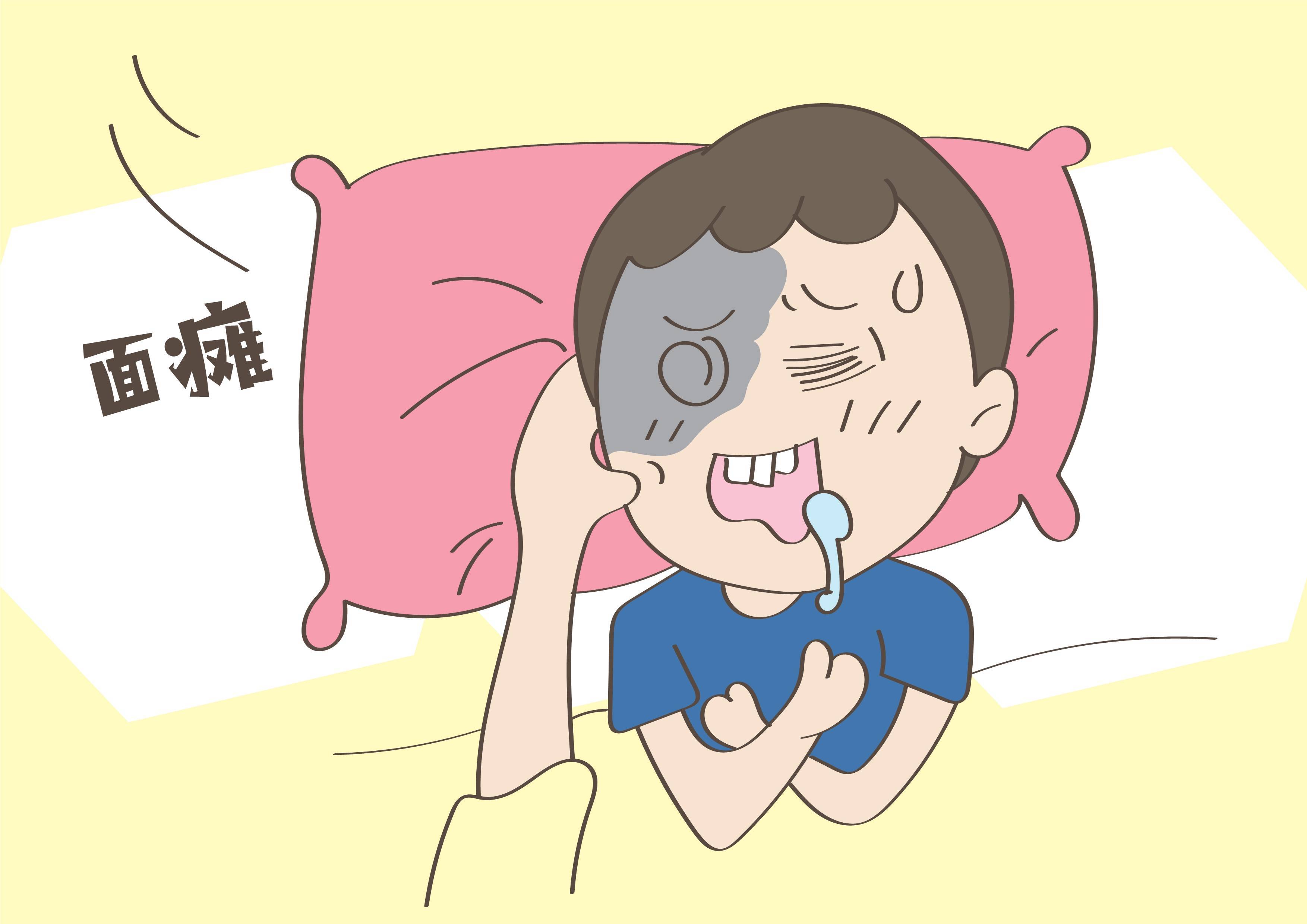 济南国医堂医院周振敏主任讲解——面瘫的日常护理_治疗_患者_疾病