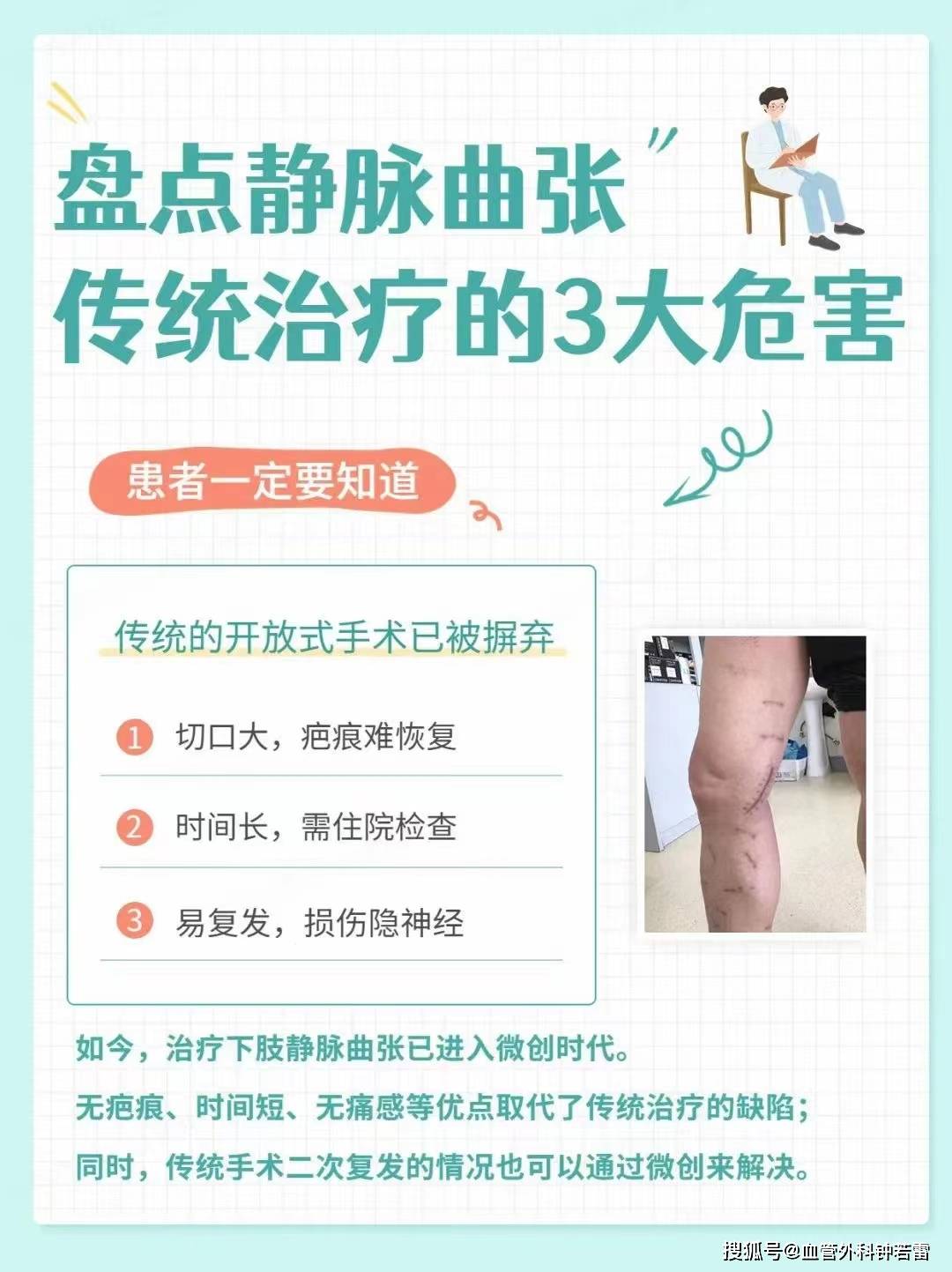 怎样治疗静脉曲张好得快？-怎样治疗静脉曲张好得快的方法视频