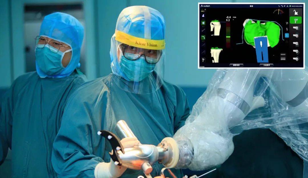 北京协和医院骨科团队参与研发的国产关节手术机器人再升级