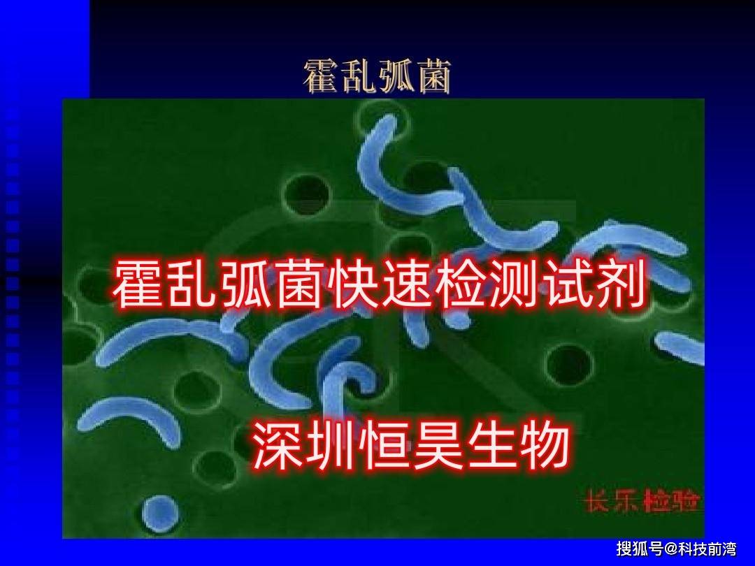 霍乱弧菌测定试剂盒使用说明书_试纸_检测_抗体