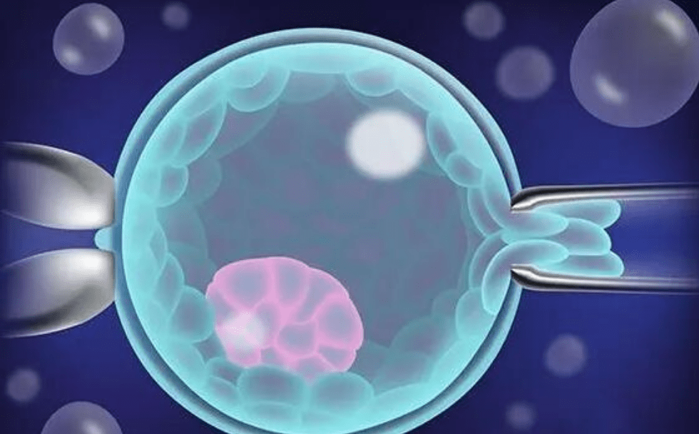 特纳氏综合征供卵试管婴儿_患者_成功率_进行