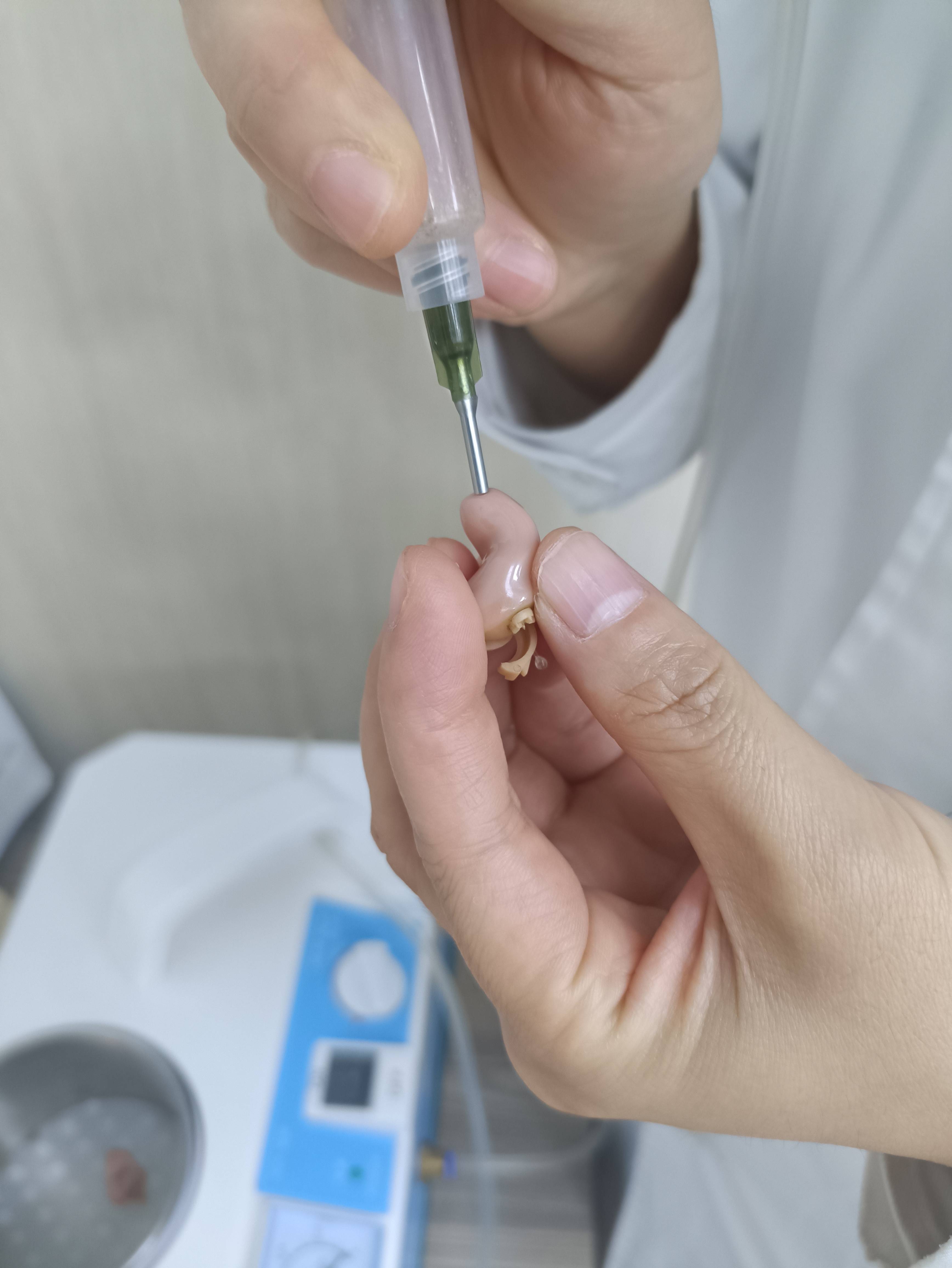 定期到专业的助听器验配中心进行保养,尽量每个月保养一次,如果耵聍