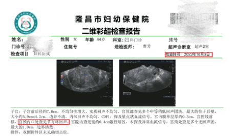 子宮腺肌病--曼月樂環還可以這樣安_患者_藥物_治療