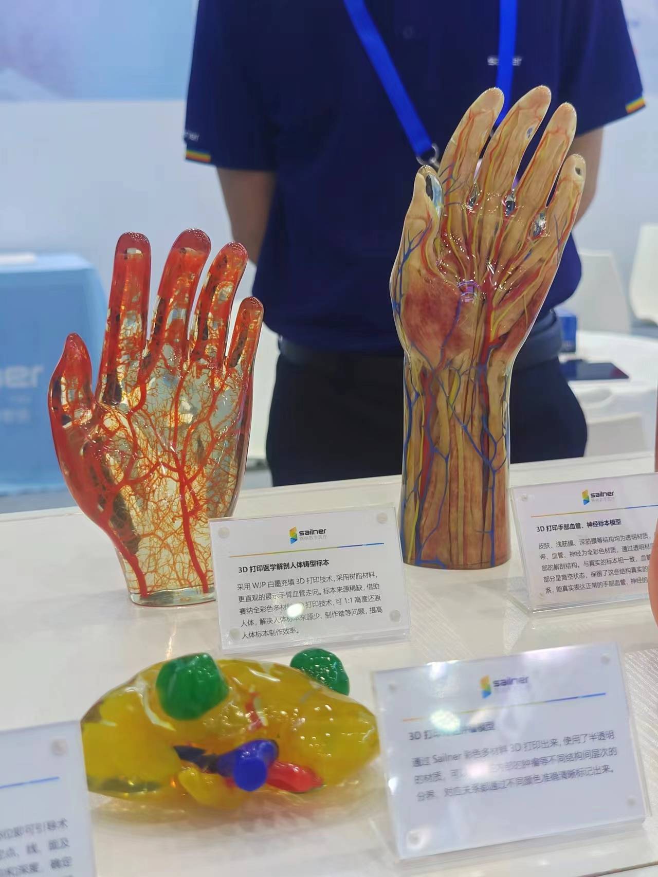 赛纳数字医疗3D打印医疗模型