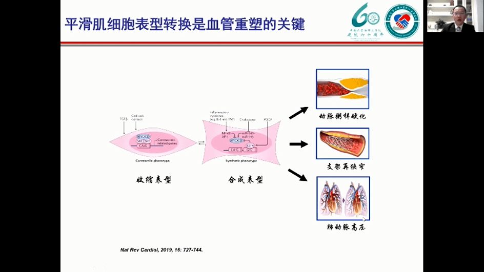 而平滑肌细胞表型转换则是血管重塑的关键,当平滑肌由收缩表型转变为