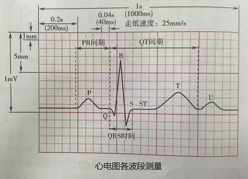 这是记录心电图的纸,横向坐标是时间,纵坐标是电压.