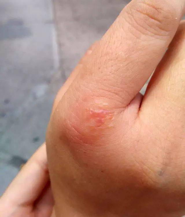 野塘钓鱼,被这满身黑纹的家伙咬了一口_连中数