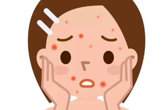 天天吹空调湿气太重了还易没劲爆痘看看你有吗