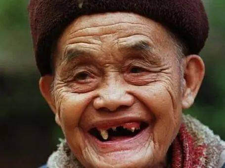 【科普】中老年人对于牙齿的常见误区有哪些?