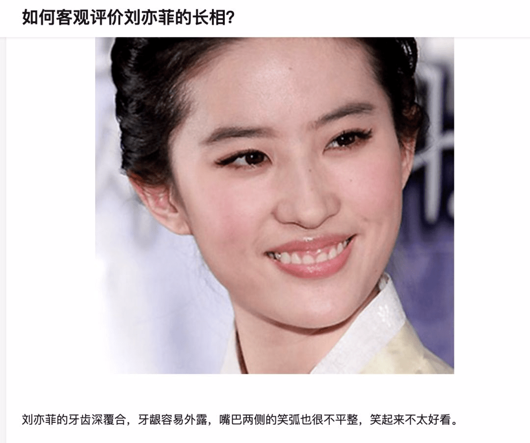 早期刘涛的牙齿也不甚美观,做了烤瓷牙之后更是被娱乐媒体称为改头换