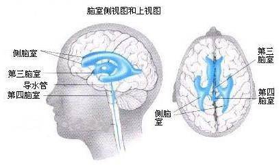 内镜下第三脑室肿瘤切除术