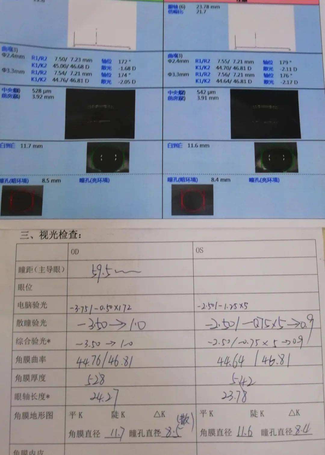 保护心灵的窗户马虎不得丨拿着处方去配镜
