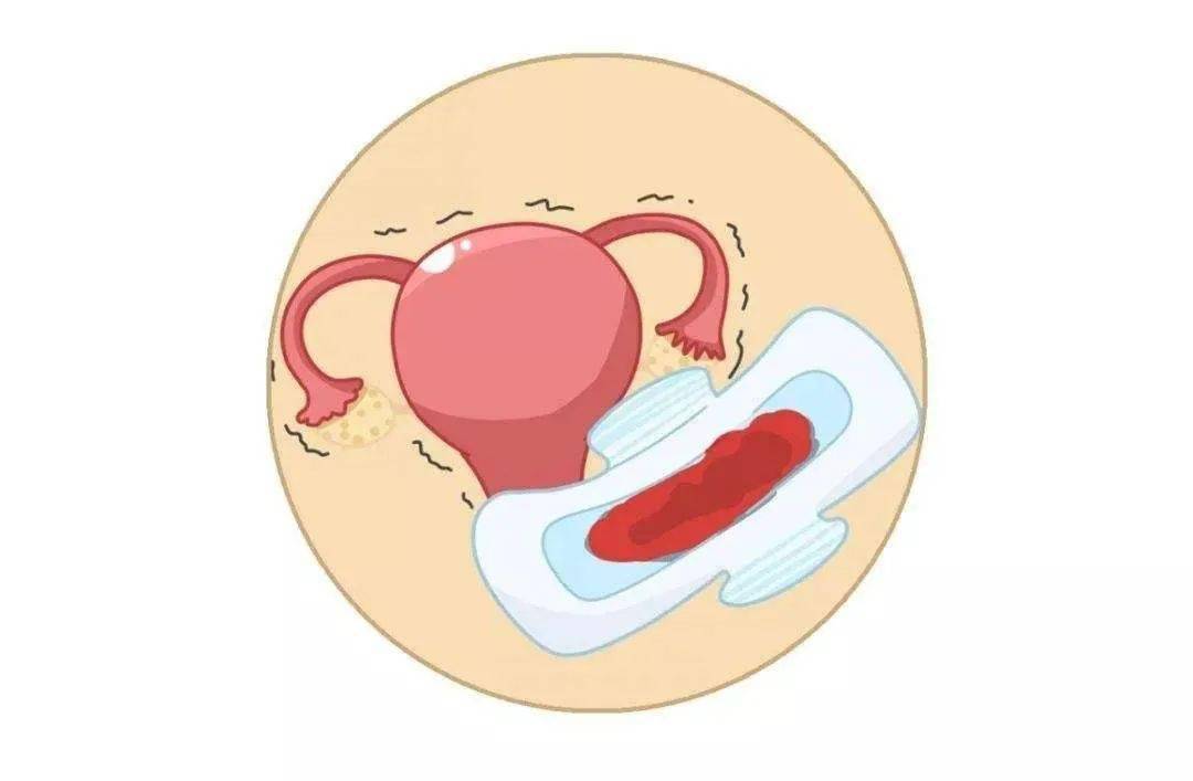陰道出血不一定是大姨媽,還可能是「功血」!聊聊「正常月經」