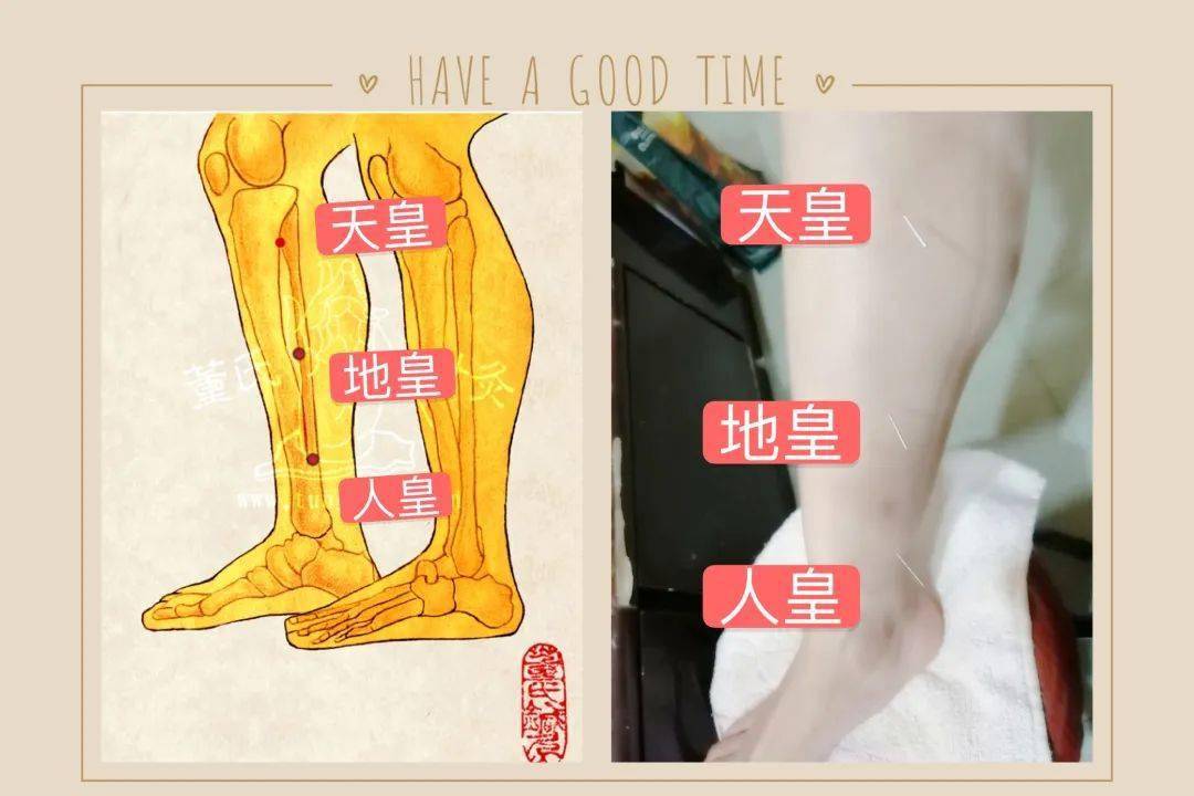 下三皇:补肾强身的要穴上高,下高:除了增高还治少腹上高,下高,下三皇