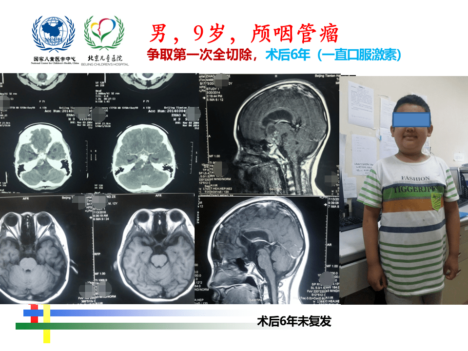 解剖课件 儿童鞍区肿瘤常见手术入路 北京儿童医院葛明