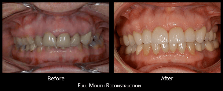 张口受限咀嚼肌疼痛这家三甲医院康复科开设的专科门诊能帮到你