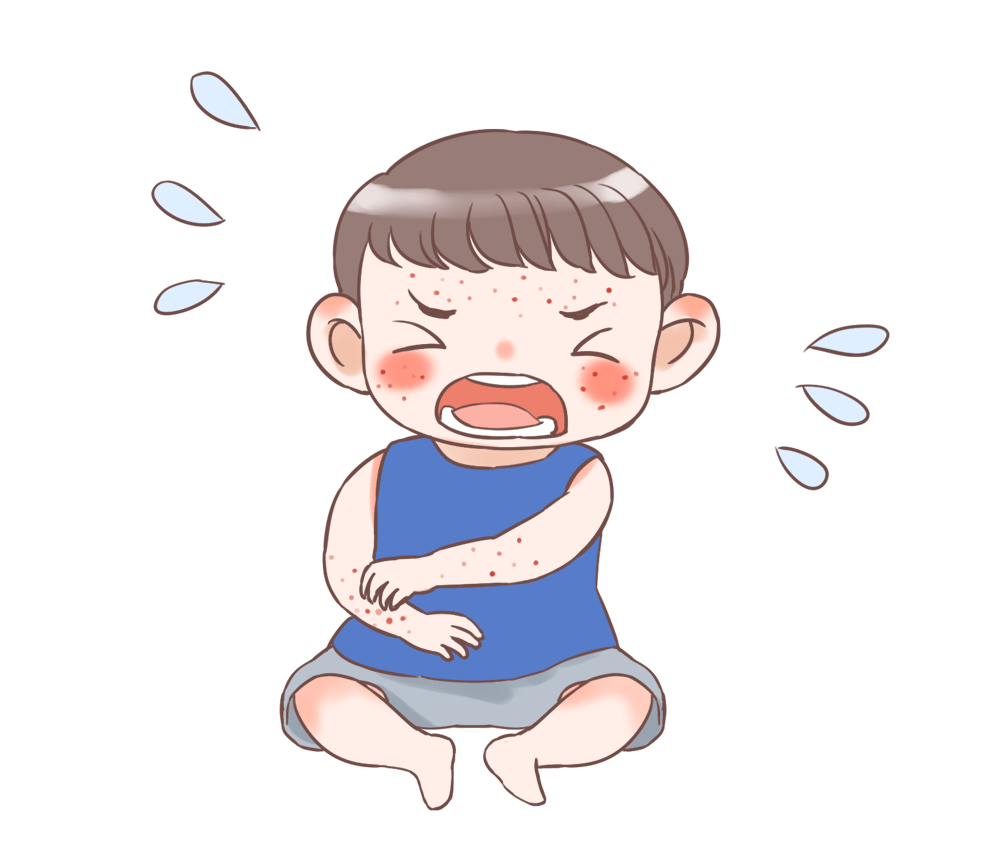 健康科普入夏了为啥宝宝的湿疹还是反反复复