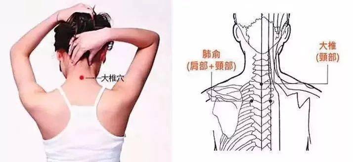 脖子后面有个地方万万不能堵一定要打通