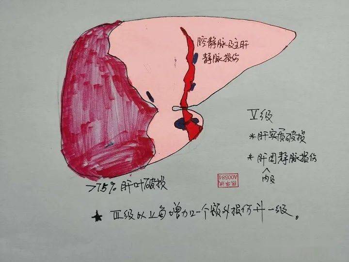 畫圖aast肝臟破裂傷的分級