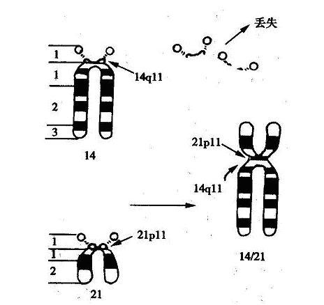 【孕产课堂】反复流产,原来是染色体"出错"了!