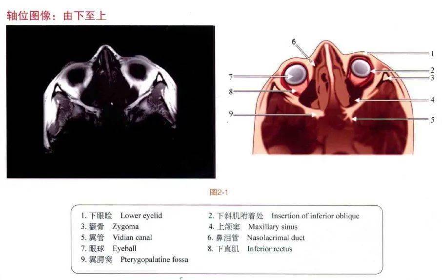 眼眶mri断层解剖速查图谱眼科基础解剖精选图集