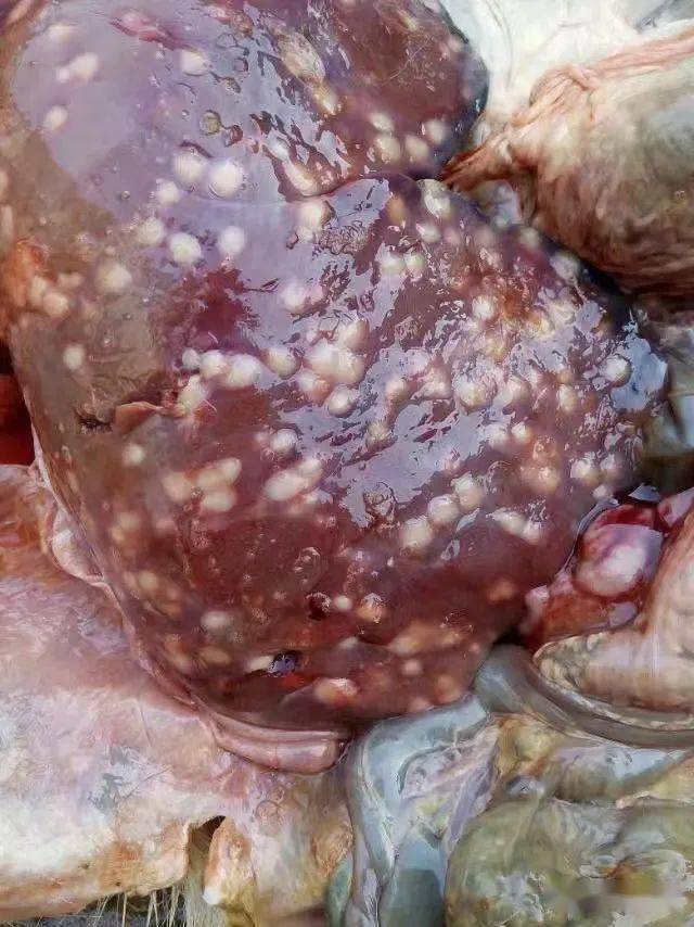 肝吸虫虫在肝里的图片图片