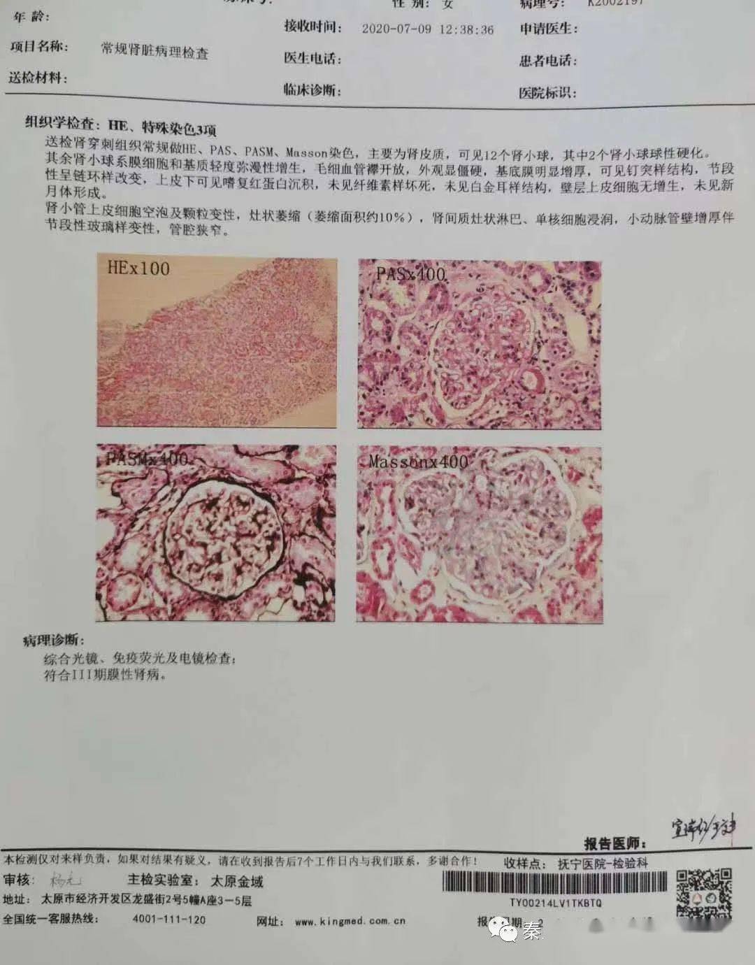 什么是肾穿刺活检术?穿刺前需要做哪些准备?