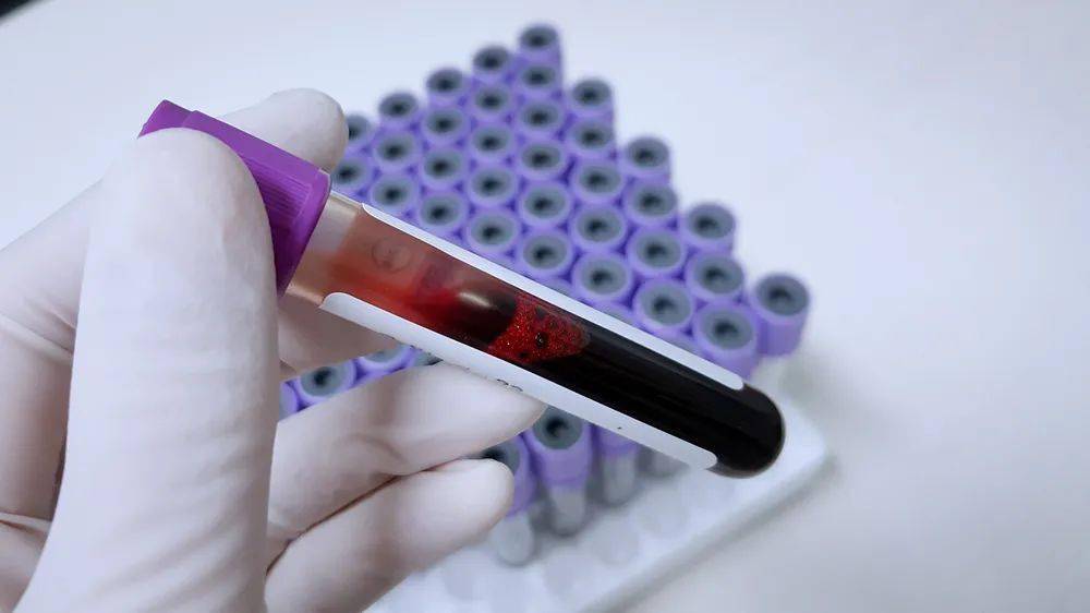 血hcg结果与临床严重不符难道我测错了