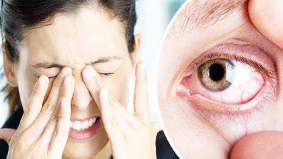眼睛干涩疲劳是什么原因