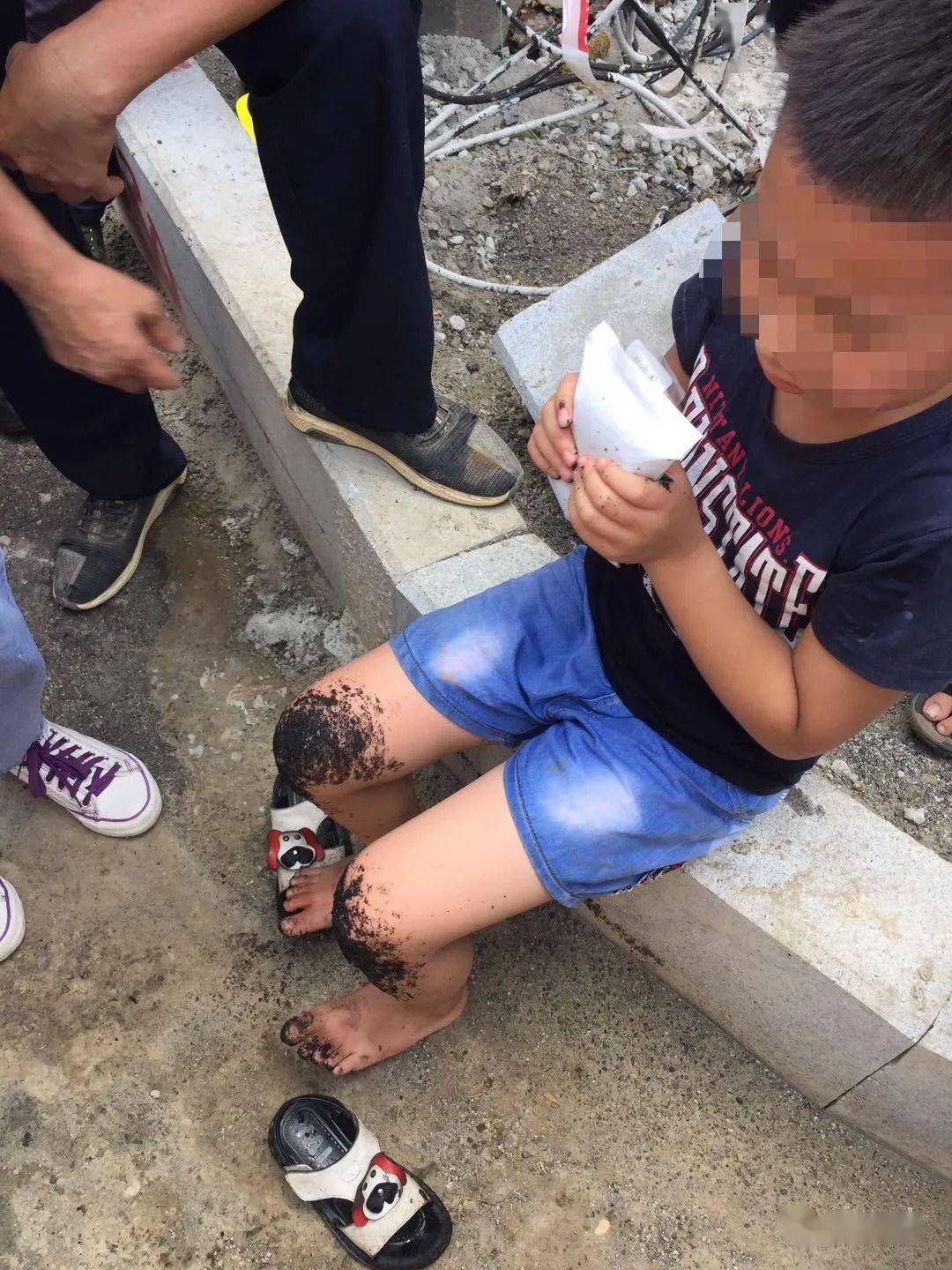 危险!南部一小孩被沥青烫伤