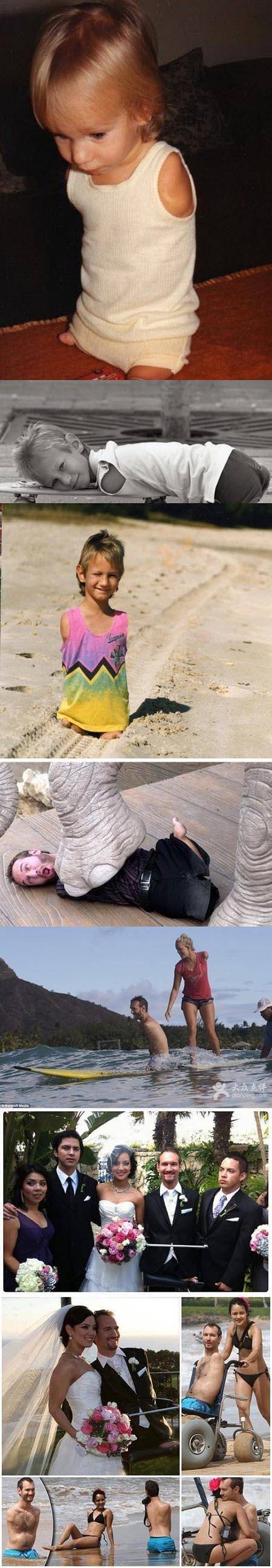 他没有四肢却依然坚强幸福地生活触动心灵的照片