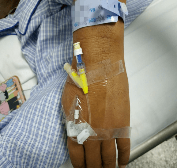 患者李某,"右手外伤"入院后给予静脉补液对症治疗,巡视病房时患者述