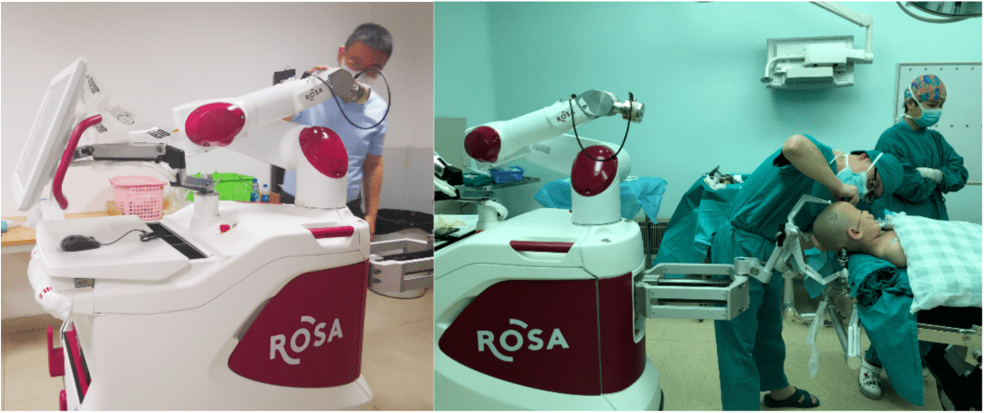 rosa手术机器人图片