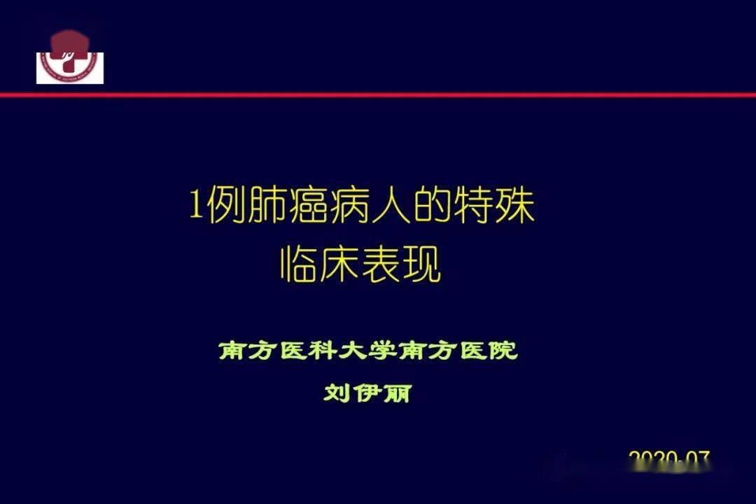 欢迎大家关注刘伊丽教授微课堂返回搜狐,查看更多