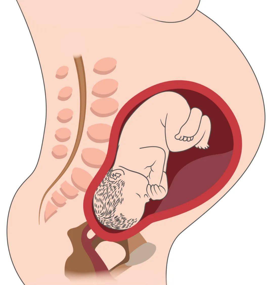怀孕后期,胎儿的头部开始通过骨盆入口进入骨盆腔