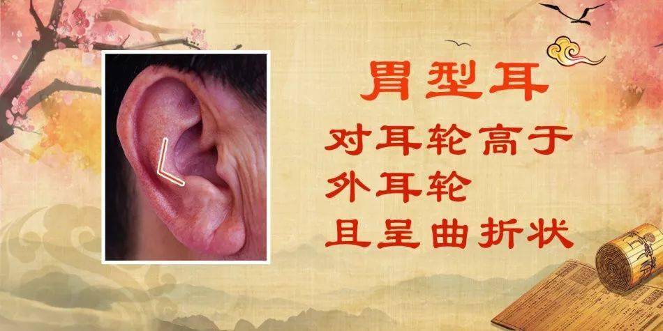 耳朵形状也能查胃病?这个征兆可能是湿热!一丸一菜帮你调
