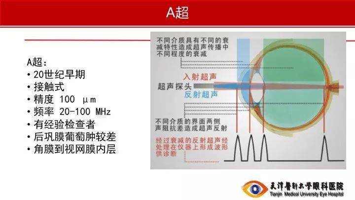 【眼視光】眼軸長度解析_測量