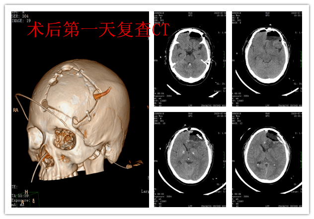 张家港心脏科：守护健康的心脏医生们