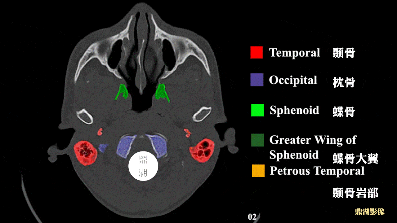 颅底详细断层解剖