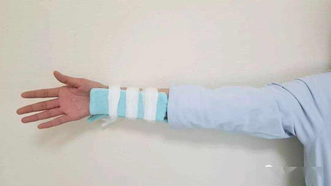 骨折后小夹板固定记住这九点保你妥妥的