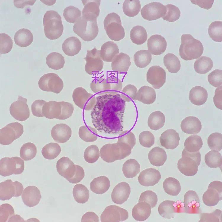 07形态特征:胞体圆形或类圆形;胞质较少,淡蓝色,可见少量细小颗粒