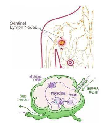 具体这些结构我们给大家分析一下,淋巴结指的是淋巴系统里面每走一个