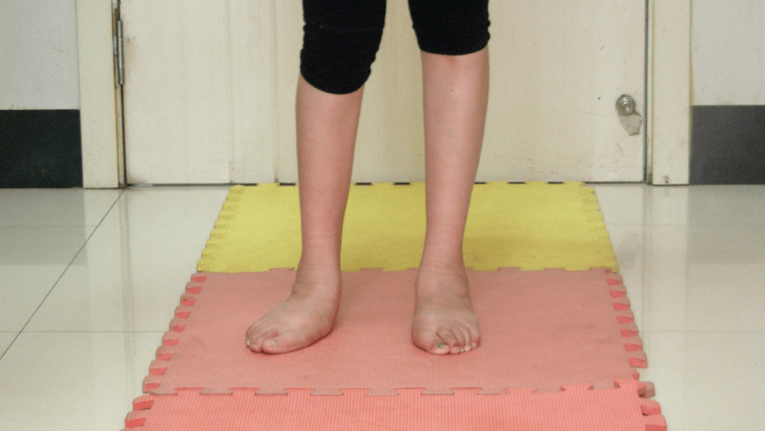 翻交叉步膝反屈髋关节脱位爪形手 垂腕不随意运动上肢痉挛可导致肩