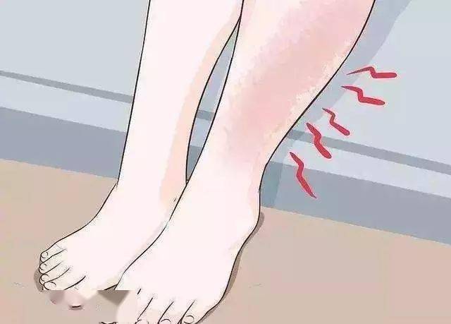 02,肢体疼痛伴肿胀