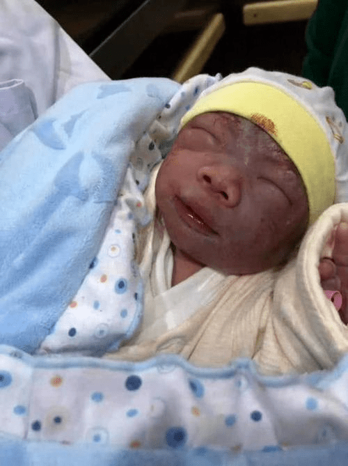 最丑宝宝火了满脸皱纹像老头宝妈10月好吃好喝白伺候了