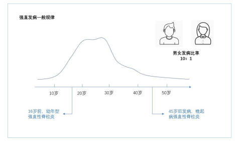 专家科普:强直性脊柱炎40岁后会停止发展不用治疗吗