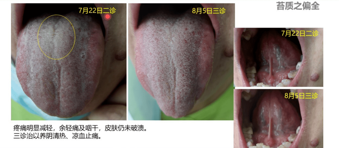 看图学苔质厚薄真假润燥偏全腐腻你会辨别吗