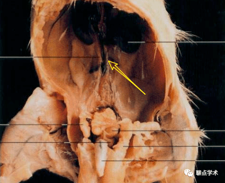 大鼠肾间质纤维化模型(uuo法)构建方法剖析
