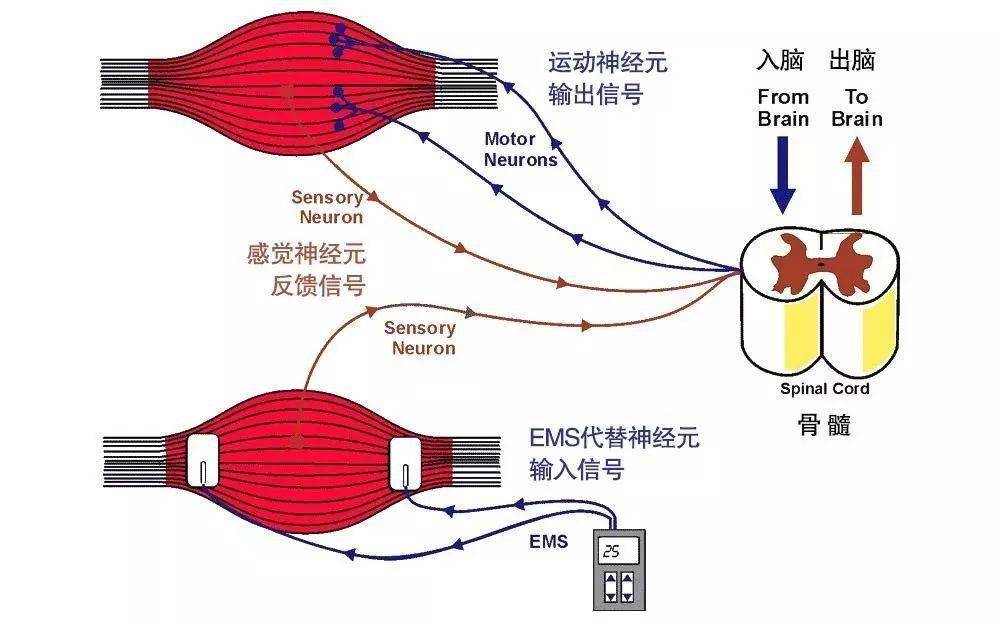 ems,英文全称electric muscle stimulation(肌肉神经电刺激),或者nmes